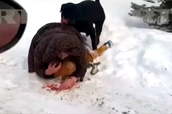 Anne, Çocuğunu Köpekten Kendi Bedeniyle Korumuş!